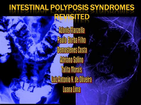 Figure 1 From Intestinal Polyposis Syndromes Revisited Semantic Scholar