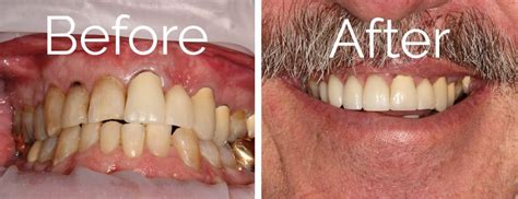 Before and After Dental | Knoxville, TN Dentist