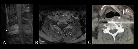 Image Guided Head And Neck Biopsies From Superficial To Deep