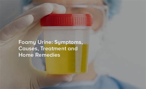 Urology Hospital in Hyderabad | Foamy Urine: Causes & Treatments