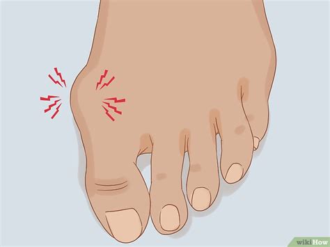 How To Treat A Swollen Toe Symptoms Causes And Treatments