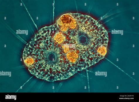 Amoeba Protozoa Interphase Contrast Light Micrograph Of Two Amoeba Sp