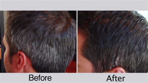 Before And After Men S Hair Color For Covering Gray Hair YouTube