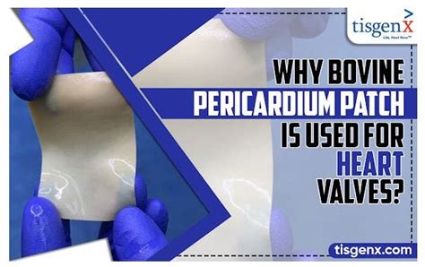 Bovine Pericardial Tissue Patch Safety And Regulatory Considerations By Tisgenx Inc Aug