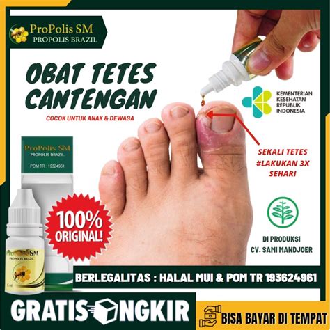 Jual Obat Tetes Cantengan Jempol Kaki Tangan Bengkak Bernanah