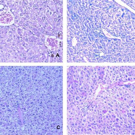 Histopathological Analysis Of Liver Specimens Of Different Groups After