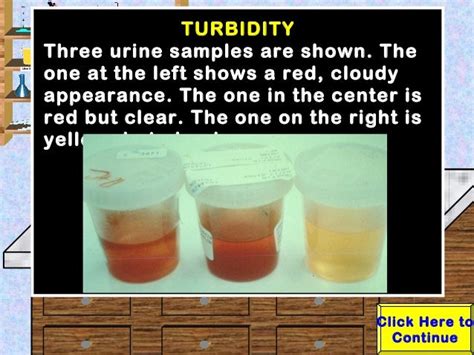 Urinalysis Lab