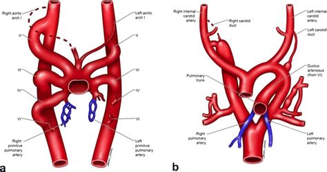 A Illustrations Depicting The Developing Six Paired Aortic Arches With