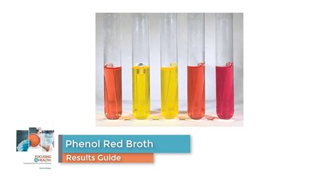 Phenol Red Broth Expected Results Guide Youtube