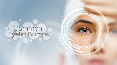 Eyelid Bumps? | Common Conditions and Symptoms