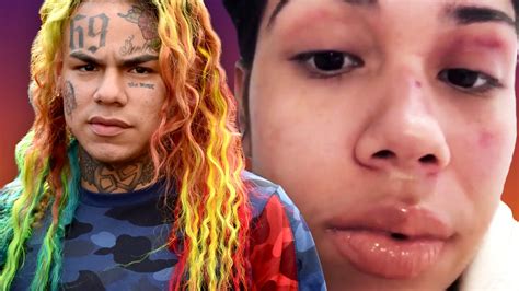 Tekashi69s Ex Girlfriend Sara Molina He Beat Me So Badly ‘i Could