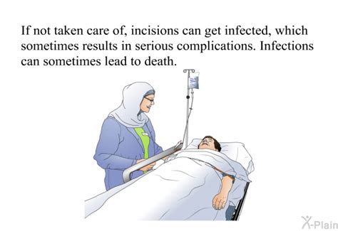 PatEdu.com : Incision Care