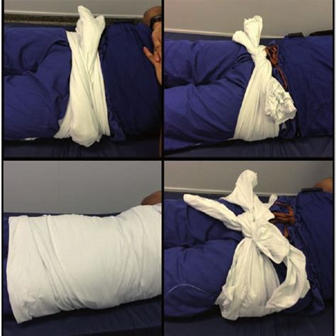 Pdf A Bed Sheet Is Not As Effective As A Pelvic Circumferential