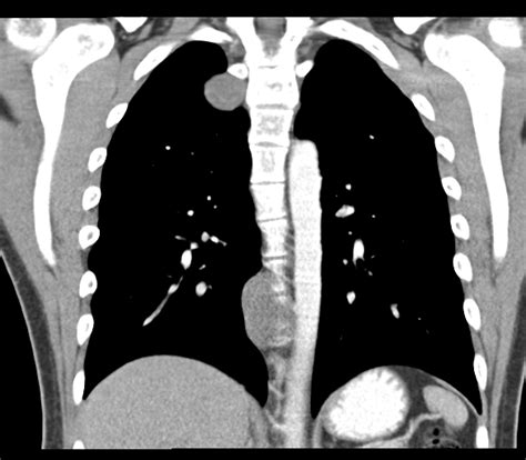 Image Radiopaedia Org