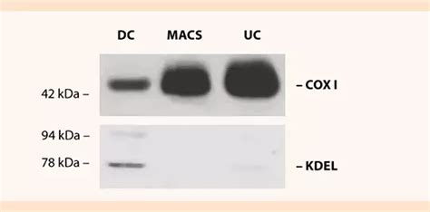 Mitochondria Isolation Kit Human Miltenyi Biotec Usa