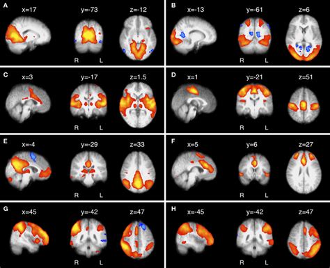 Eight Of The Most Common And Consistent Rsns Identified By Ica A