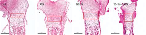 Resveratrol Promotes The Expansion Of The Bmp9 Induced Hypertrophic