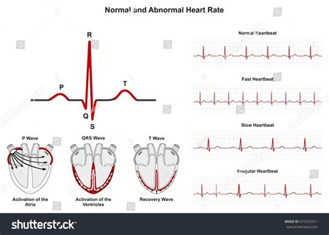 2,053 Normal Ecg Images, Stock Photos & Vectors | Shutterstock