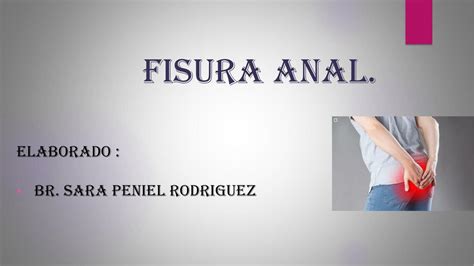 Fisura Anal Sara Peniel UDocz