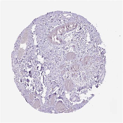 Tissue Expression Of Cd68 Staining In Colon The Human Protein Atlas