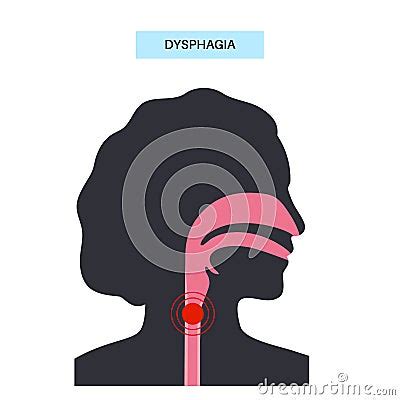 Dysphagia Medical Poster Cartoon Vector Cartoondealer