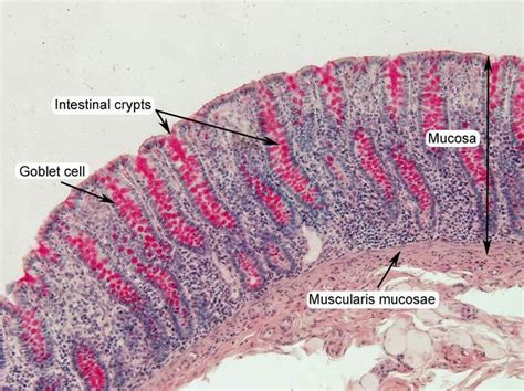 Large Intestine Histology Note No Gastric Pits No Villi Note