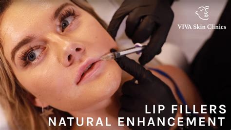 Natural Lip Fillers London Viva Skin Clinics Youtube