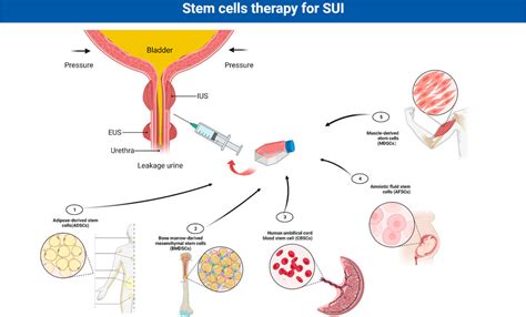 Frontiers Advances In The Molecular Pathogenesis And Cell Therapy Of