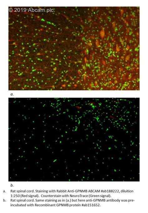 Recombinant Human GPNMB protein ab151652 アブカム