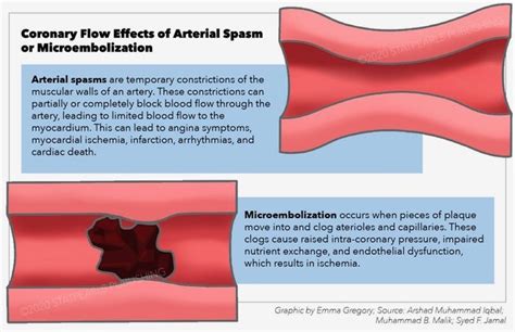 Figure Coronary Flow Effects Of Arterial Statpearls Ncbi