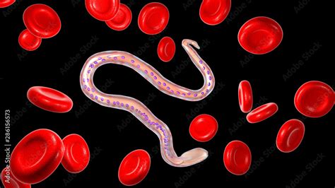 Wuchereria Bancrofti A Roundworm Nematode One Of The Causative Agents Of Lymphatic Filariasis