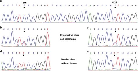 Molecular Alterations In Endometrial And Ovarian Clear Cell Carcinomas