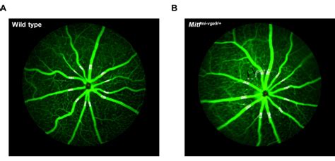 Measuring Retinal Vessel Diameter From Mouse Fluorescent Angiography Images