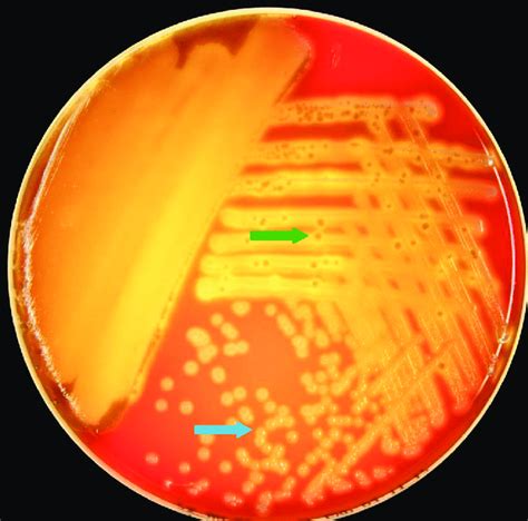 Streptococcus Pneumoniae Morphology