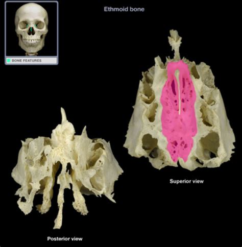 Dissection Ethmoid Mandible Maxilla Flashcards Quizlet