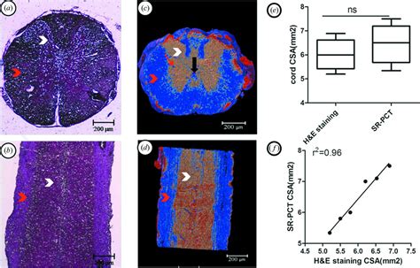 IUCr Nondestructive Imaging Of The Internal Microstructure Of