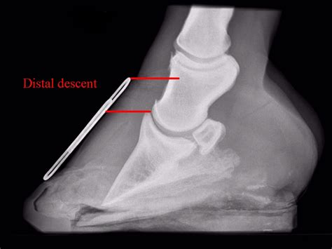 Chronic laminitis - The Laminitis Site