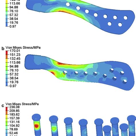 Stress Distribution On Fossa Component A Von Mises Stress On The