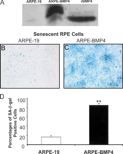 Bmp Mediates Oxidative Stress Induced Retinal Pigment Epithelial Cell