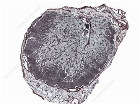 Lymph Node Cross Section Lm Stock Image C0362296 Science Photo