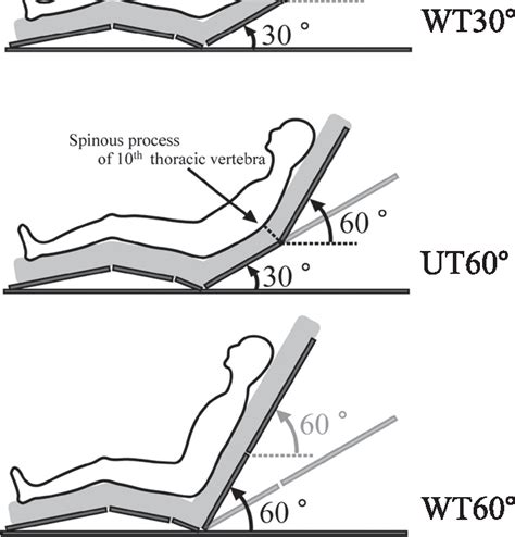 Different Fowler S Positions At Daniel Kirkland Blog
