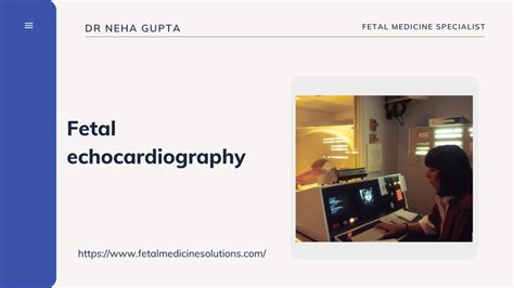 Ppt Fetal Echocardiography Powerpoint Presentation Free Download