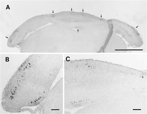 Parasagittal Expression Of C Fms In The Staggerer Purkinje Cells Of