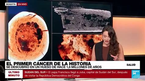 La Historia Del Cáncer Miles De Años De Convivencia Y Lucha Contra La