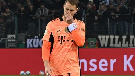 Neuer Fratura Perna E Vai Desfalcar O Bayern Contra O Psg Na Liga Dos