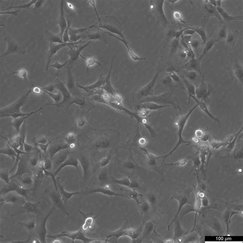 LX-2 Cells