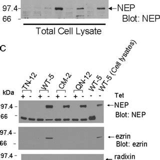 Immunofluorescence Localization Of Wild Type Nep And Site Directed