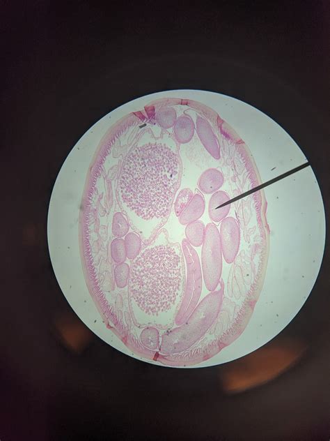 Ascaris Female Diagram Quizlet