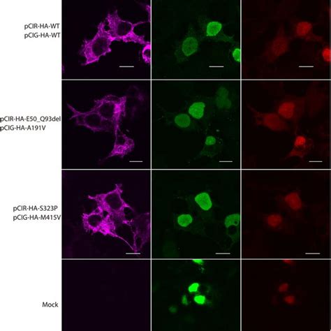 Cellular Distribution Of KCC2 Mutants In Transfected HEK293 Cells