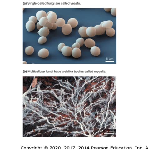 Clinical Microbio Fungi And Protozoa Flashcards Quizlet